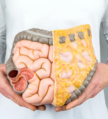 Tumor do Intestino  e Reto