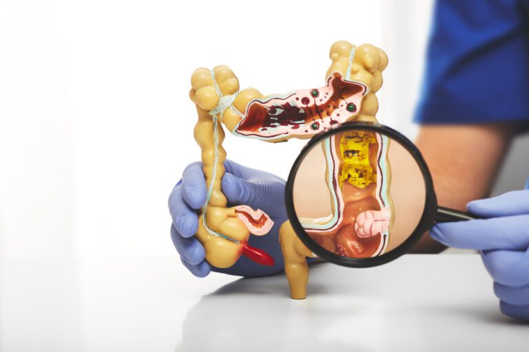 Maquete de um sistema digestivo.